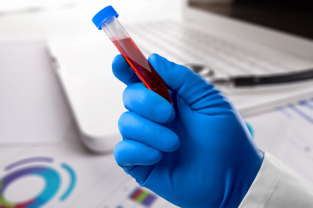 Blood tubes of patient and medical test report
